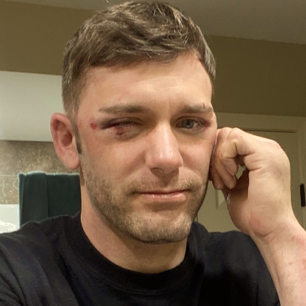 Meet your Posher, Chemical